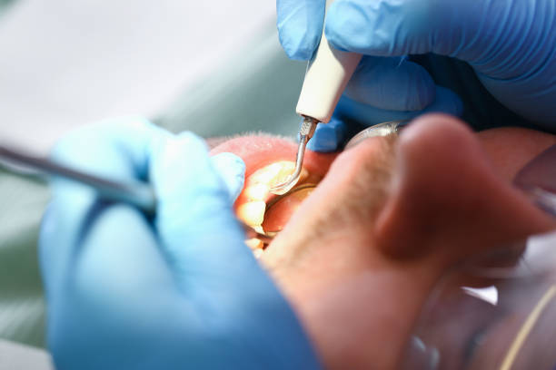 Best Walk-In Emergency Dental Services in Marshfield, WI