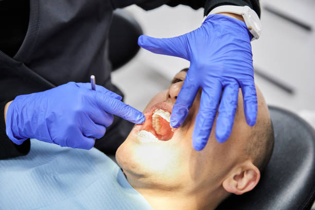 Best Emergency Root Canal Therapy in Marshfield, WI