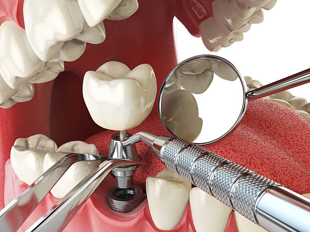 Best Emergency Treatment for Jaw Pain or Injury in Marshfield, WI